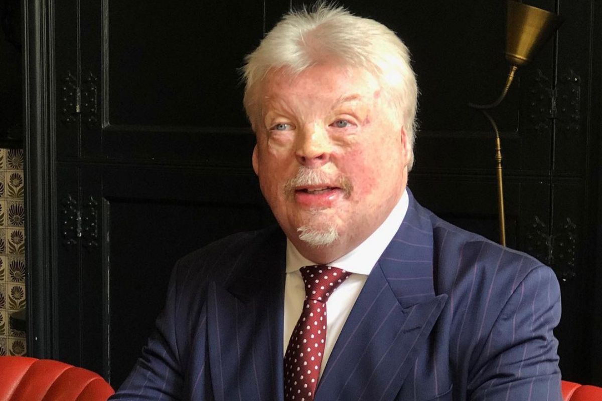 Simon Weston