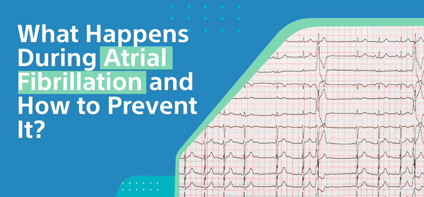 What Happens During Atrial Fibrillation 