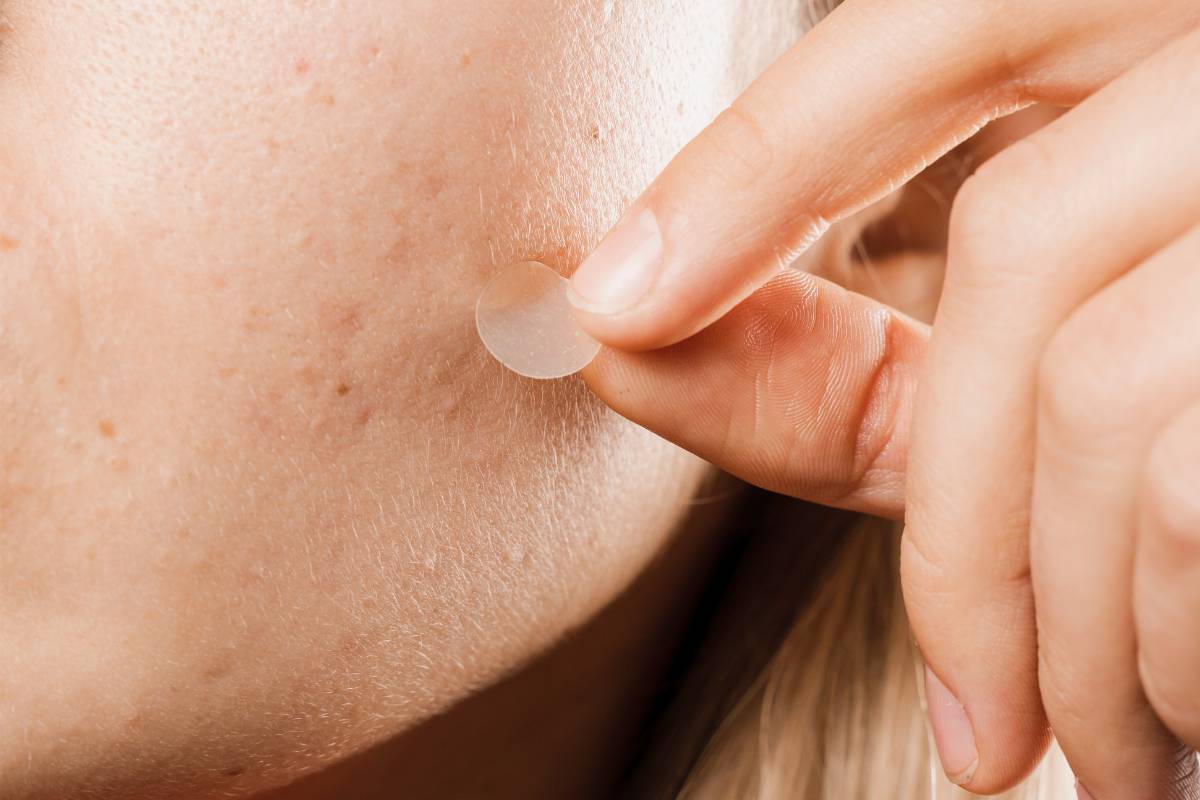 pimple patches for skincare