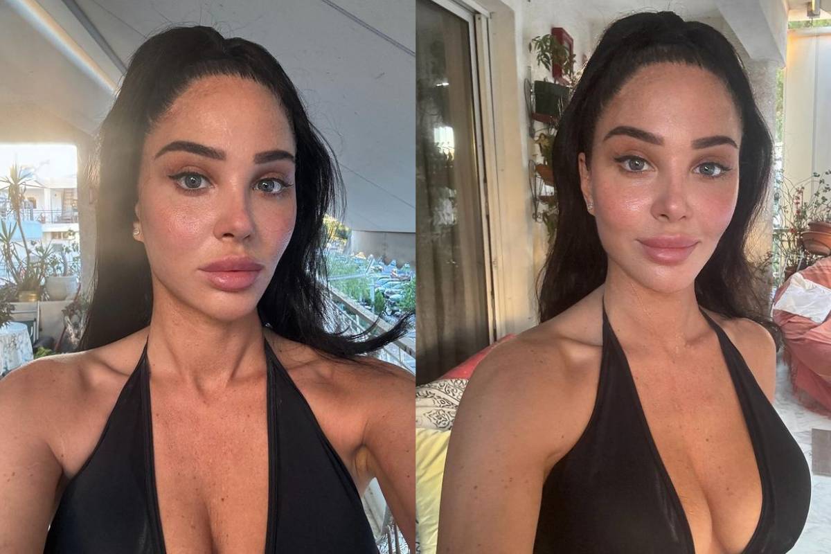 tulisa facial surgery confession